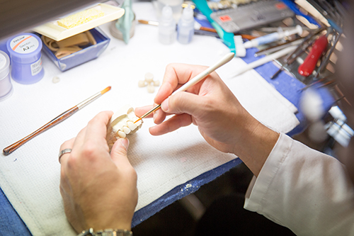 In House Full Service Dental Laboratory Silverstrom9 In House Full Service Dental Laboratory